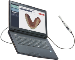 biotech-dental-scanner-condor